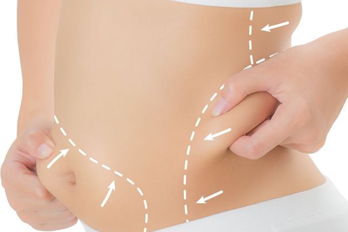 what-are-the-different-types-of-liposuction